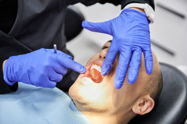 Best Dentist for Tooth Abscess  in Village Green Green Ridge, PA